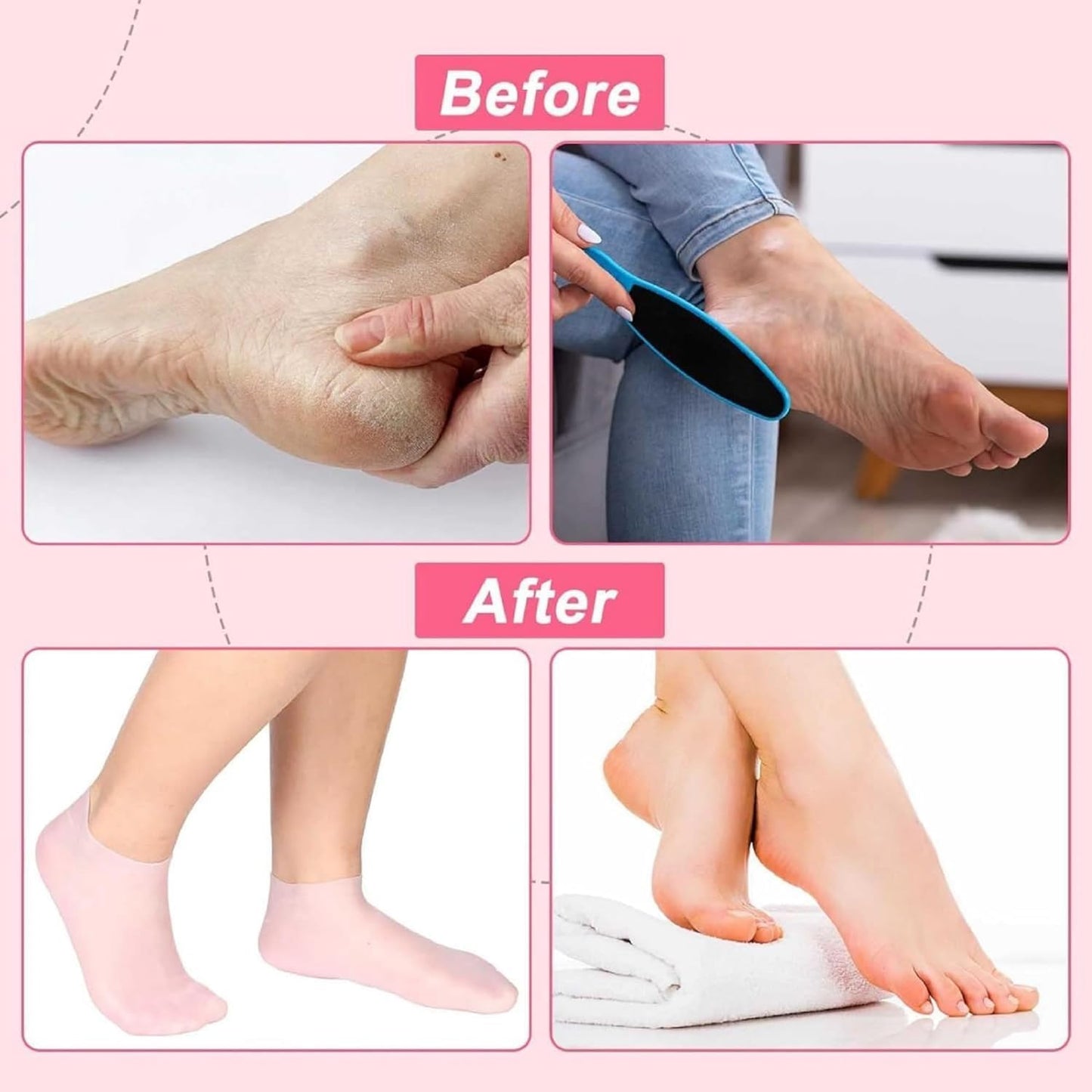 Luxury Spa Gel Socks – Deep Hydration, Moisturizing and Repair for Dry, Cracked Feet!