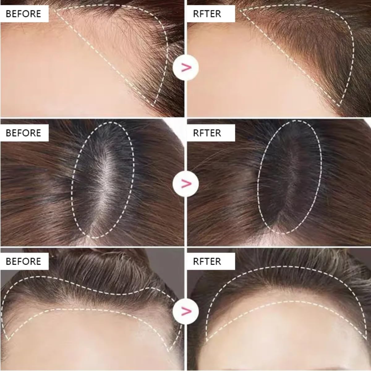 Root Cover Up and Hairline Shadow Powder