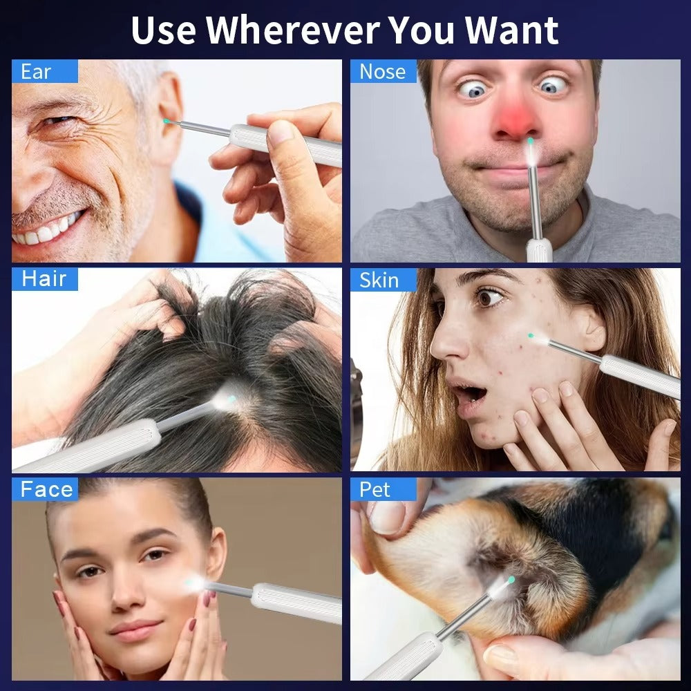 š¦»OtoCare Pro⢠Smart Visual Ear Wax Cleaner with HD Camera, Waterproof, Wireless Ear Scope, LED Lights ā Compatible with Android & iOS ā
| Money-Back Guaranteešø