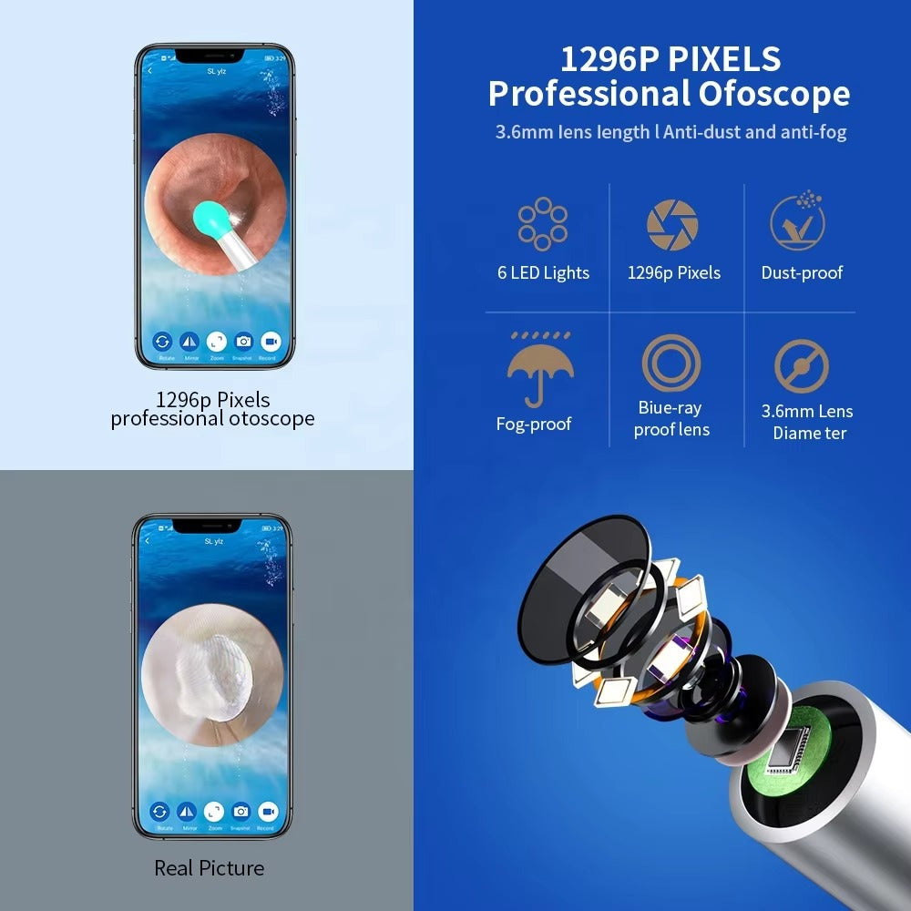 š¦»OtoCare Pro⢠Smart Visual Ear Wax Cleaner with HD Camera, Waterproof, Wireless Ear Scope, LED Lights ā Compatible with Android & iOS ā
| Money-Back Guaranteešø