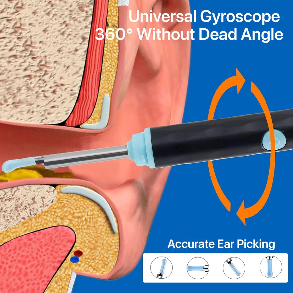 š¦»OtoCare Pro⢠Smart Visual Ear Wax Cleaner with HD Camera, Waterproof, Wireless Ear Scope, LED Lights ā Compatible with Android & iOS ā
| Money-Back Guaranteešø