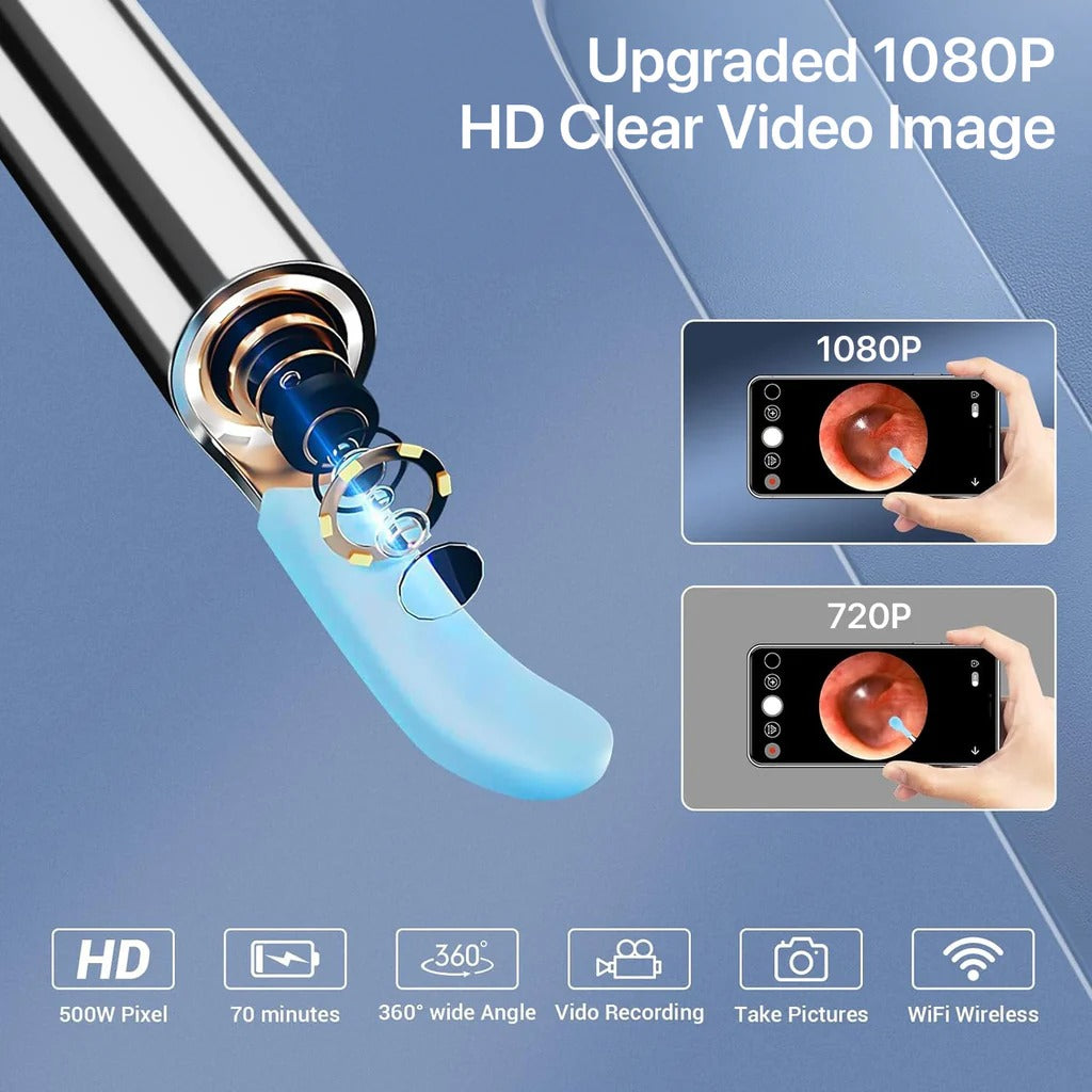 š¦»OtoCare Pro⢠Smart Visual Ear Wax Cleaner with HD Camera, Waterproof, Wireless Ear Scope, LED Lights ā Compatible with Android & iOS ā
| Money-Back Guaranteešø