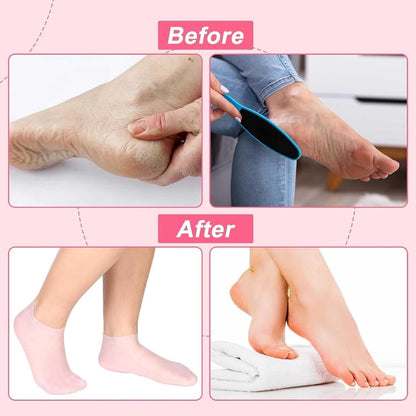 Luxury Spa Gel Socks – Deep Hydration, Moisturizing and Repair for Dry, Cracked Feet!