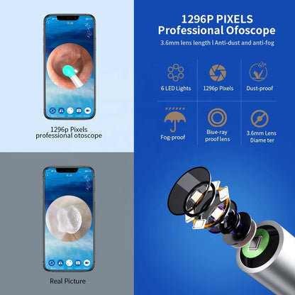 🦻OtoCare Pro™ Smart Visual Ear Wax Cleaner with HD Camera, Waterproof, Wireless Ear Scope, LED Lights – Compatible with Android & iOS ✅| Money-Back Guarantee💸